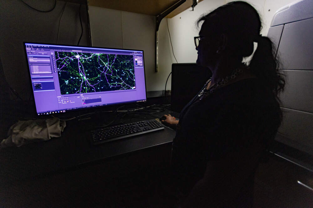 Surya Reis, executive director of the medicinal plant laboratory at Massachusetts General Hospital, looks at brain cells to see how they might react to potentially psychoactive compounds. (Jesse Costa/WBUR)